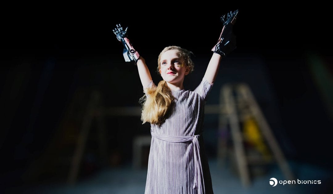 Open Bionics Tilly Bionic arms - Turning disabilities into superpowers